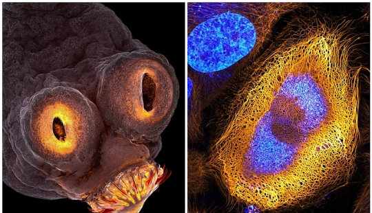 El sexo de los gorgojos, la cabeza de un gusano, la belleza del moho: el concurso de fotografía Nikon Small World anunció a los ganadores