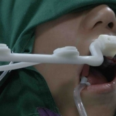 En China, un dentista robot insertó dientes humanos por primera vez