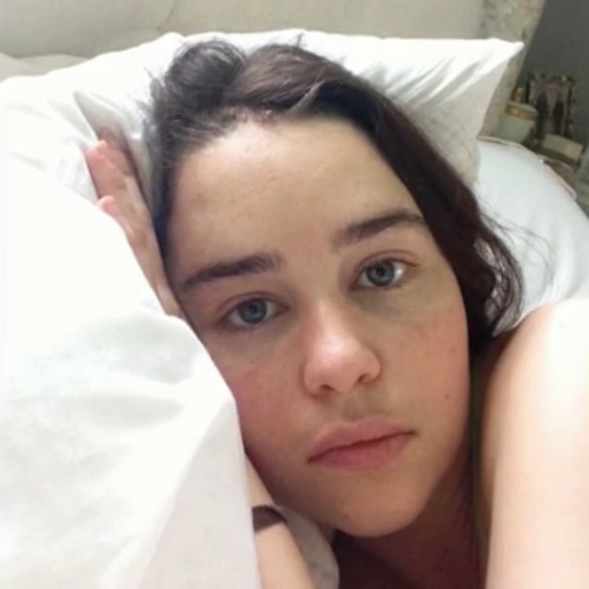 En la web aparecieron fotos de Emilia Clarke después de un derrame cerebral y una trepanación craneal