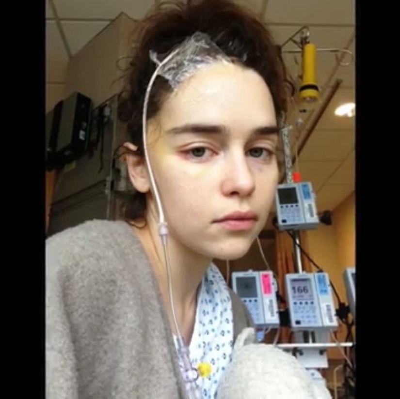 En la web aparecieron fotos de Emilia Clarke después de un derrame cerebral y una trepanación craneal