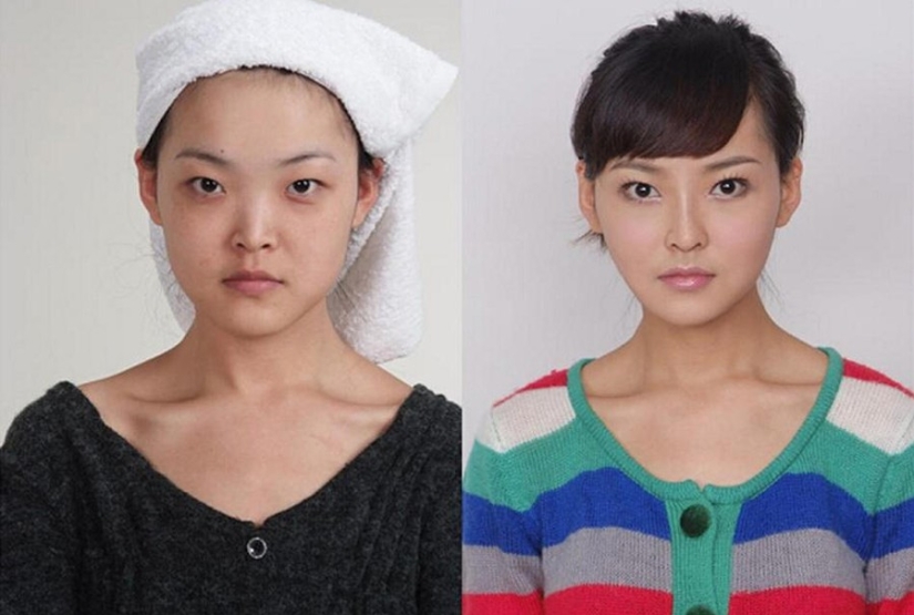 Estándares de belleza: mujeres chinas después de la cirugía plástica