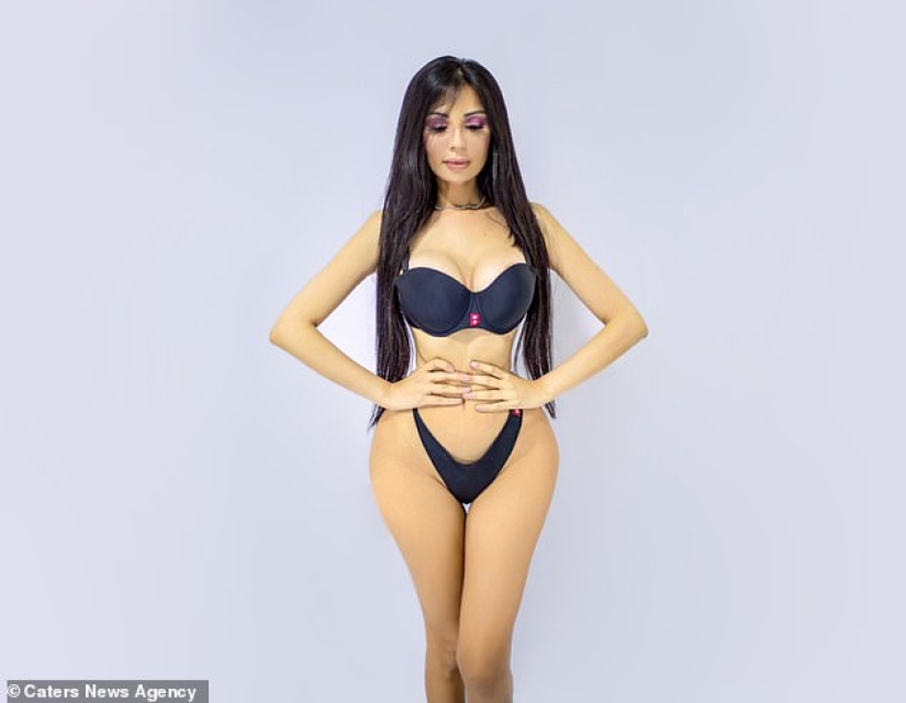 Explosive beauty: the model spent half a million dollars to look like Kim Kardashian, and almost died