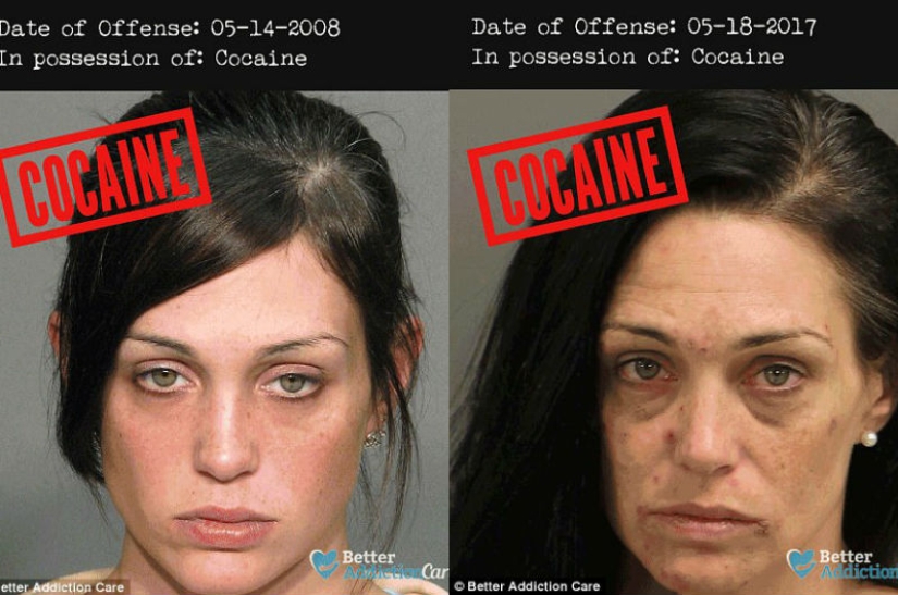 Faces of drug addicts before and after: how do banned substances affect appearance