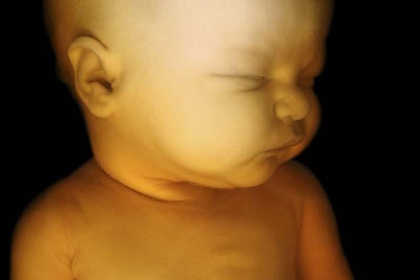 Fotos únicas: la vida de una niña antes de nacer