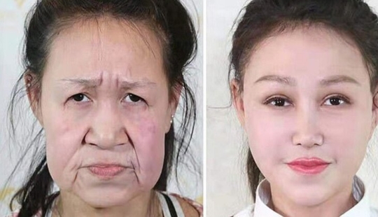 From grandmother to girl: a 15-year-old Chinese woman with an old woman's face underwent surgery From grandmother to girl: a 15-year-old Chinese woman with an old woman's face underwent surgery