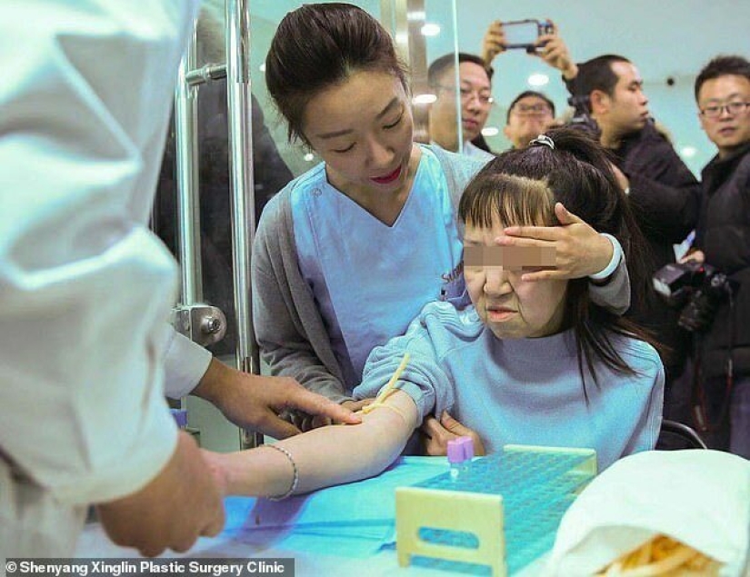 From grandmother to girl: a 15-year-old Chinese woman with an old woman's face underwent surgery