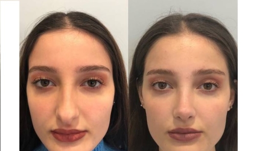 Girls before and after just one change in appearance
