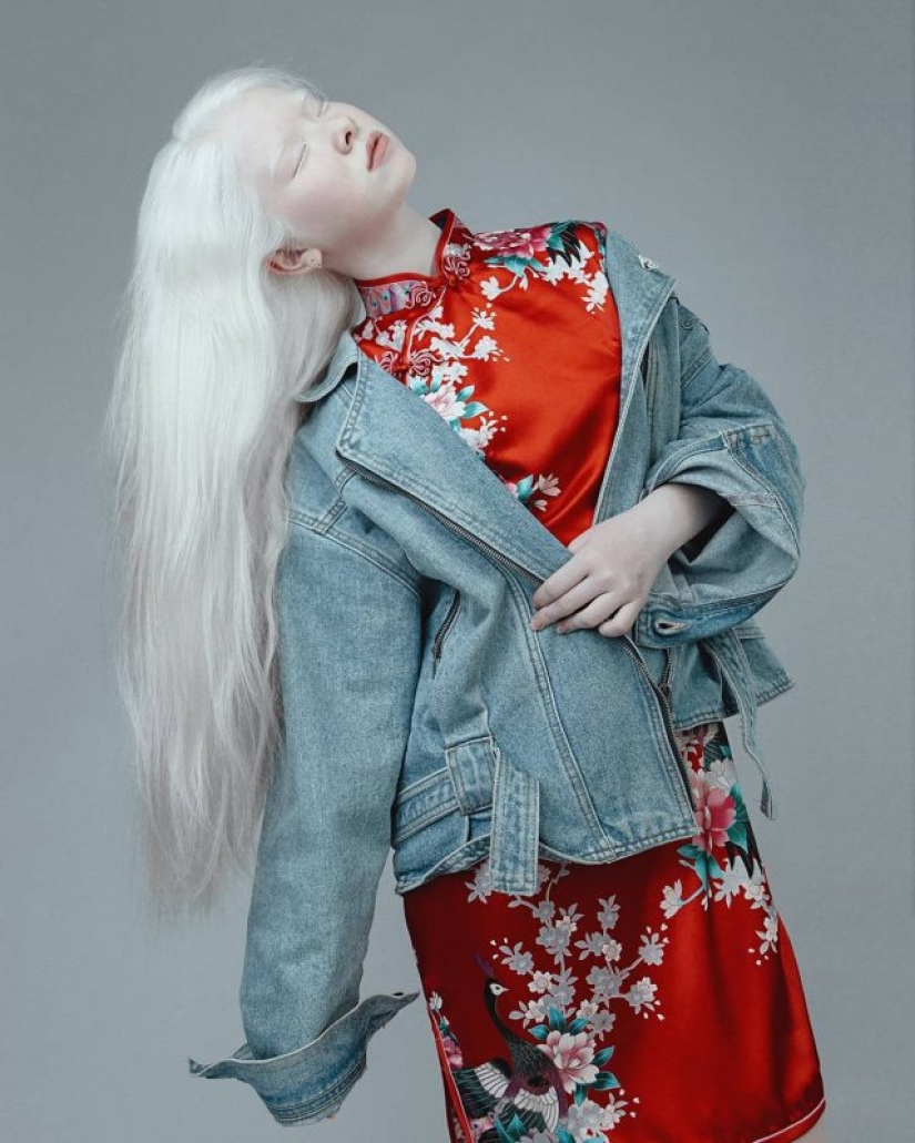 Hermanas albinas de Kazajstán conquistan el mundo del modelaje