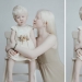 Hermanas albinas de Kazajstán conquistan el mundo del modelaje