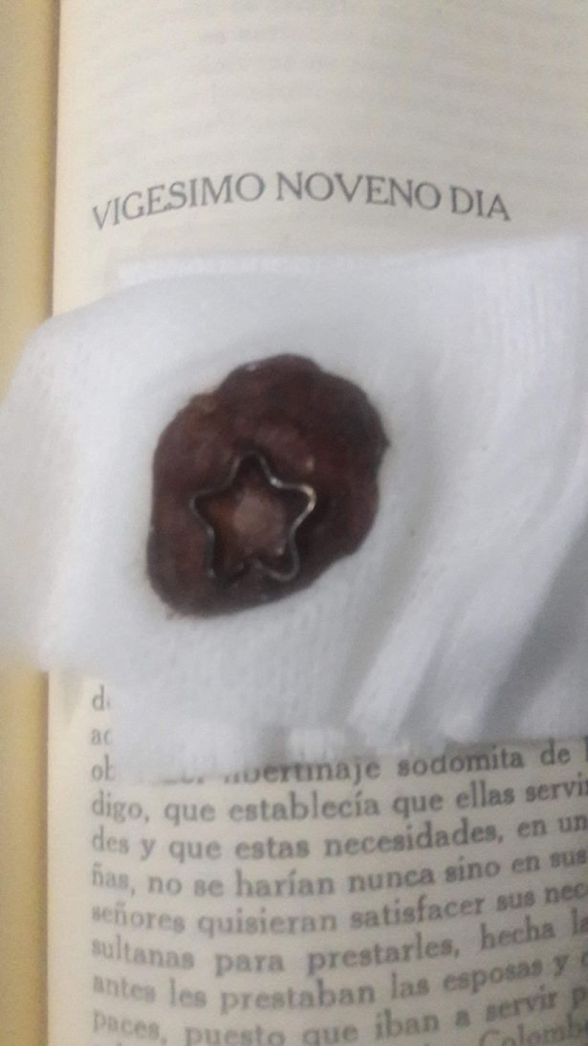 "Honey, this is for you": A 23-year-old girl removed her navel and gave it to her boyfriend