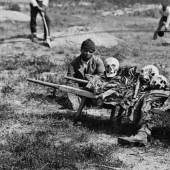 Horrifying photos of victims of the bloodiest war in US history