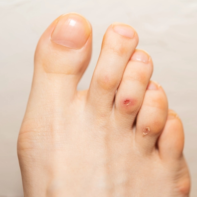 How the feet display the state of health — 8 signals about serious diseases