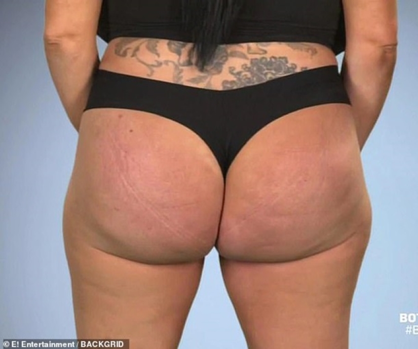 "I want a perfect hourglass": a model with giant breasts wants to enlarge her buttocks