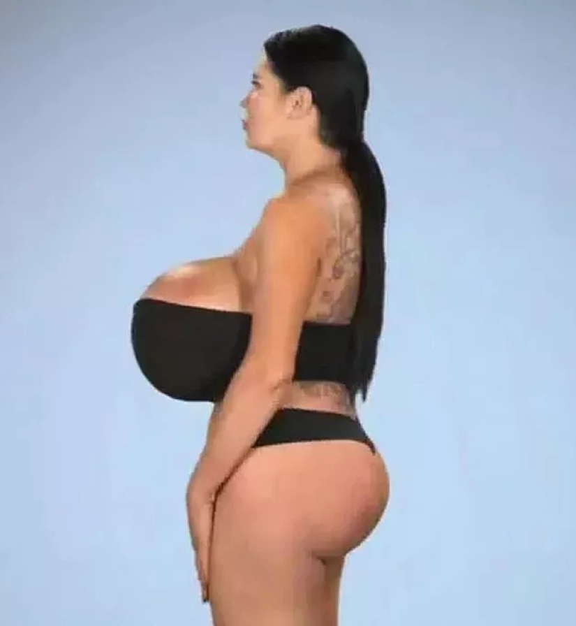 "I want a perfect hourglass": a model with giant breasts wants to enlarge her buttocks