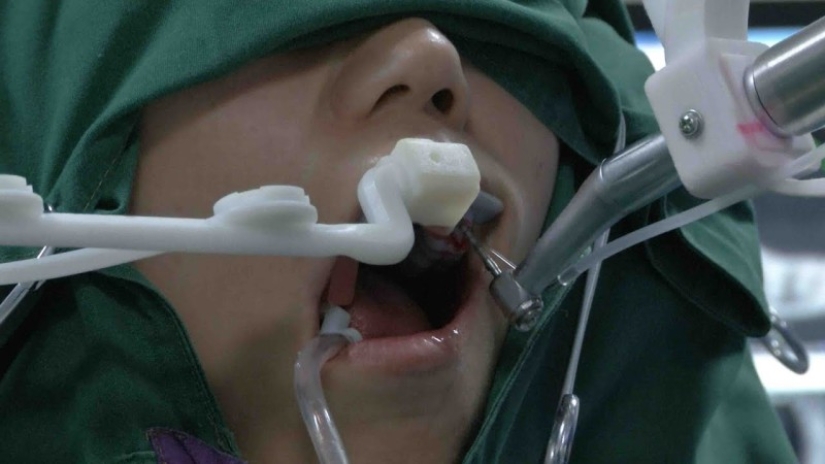 In China, a robot dentist inserted human teeth for the first time