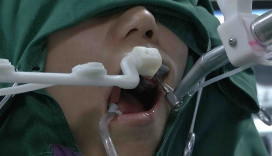 In China, a robot dentist inserted human teeth for the first time