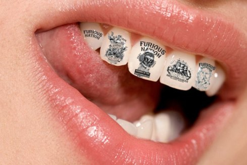 Is it fashionable? I give you a tooth! How outrageous fashion crept into dentistry