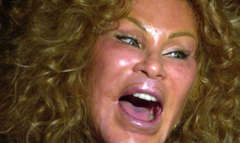 La loca vida de la multimillonaria Jocelyn Wildenstein, conocida como "Catwoman"