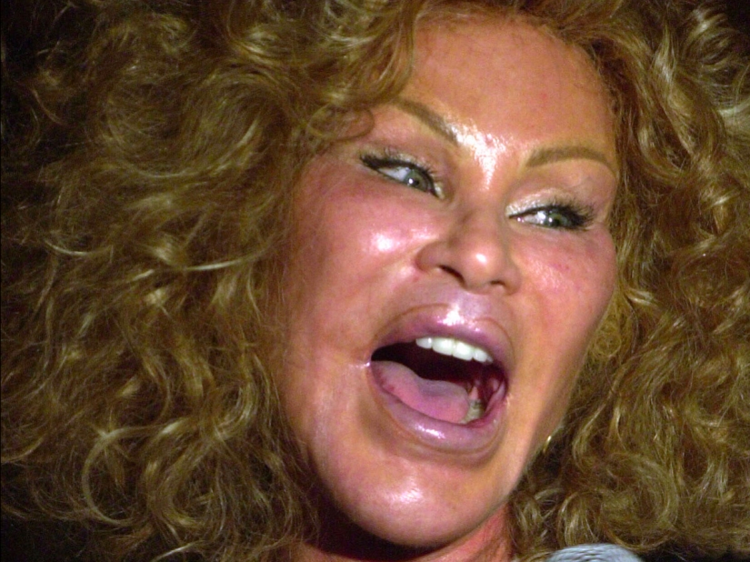 La loca vida de la multimillonaria Jocelyn Wildenstein, conocida como "Catwoman"