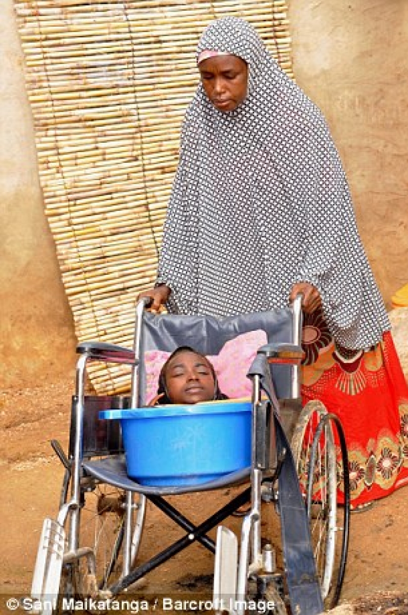 La niña de la cuenca: la historia de una mujer nigeriana con la cabeza de una mujer adulta y el cuerpo de un bebé