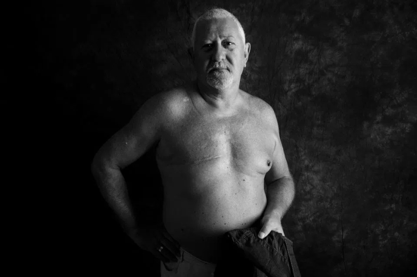 La verdad desnuda: Pacientes valientes se enfrentan al cáncer mostrando cicatrices en el conmovedor proyecto fotográfico de Ami Barwell