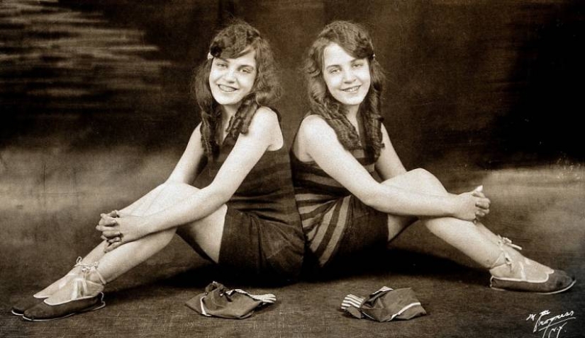 La vida de las gemelas siamesas Daisy y Violet Hilton