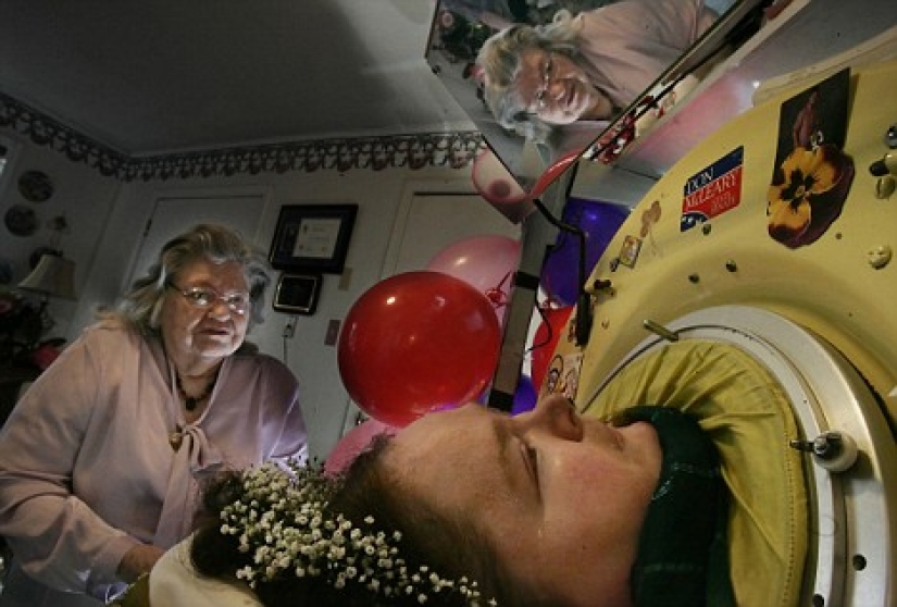 Life in the "tank": a woman spent almost 60 years in a ventilator