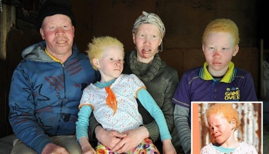 Los albinos africanos no ocultan sus miedos