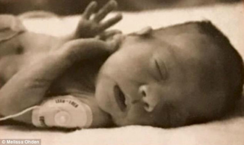 "Mi madre abortó a los 8 meses, pero sobreviví": Melissa Auden pudo perdonar y escribió un libro