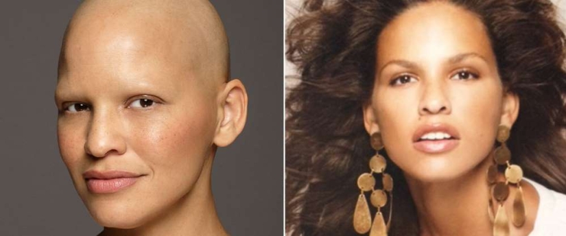 Model Mieko Rai: "I have stage three breast cancer and I have never felt more beautiful"