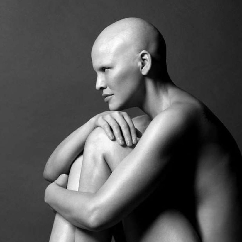 Model Mieko Rai: "I have stage three breast cancer and I have never felt more beautiful"