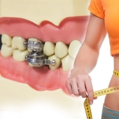 Mouth shut: scientists from New Zealand have come up with an ingenious way to lose weight