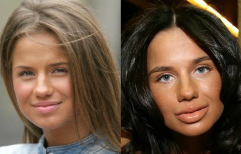 "No labios, sino albóndigas": 8 estrellas rusas que se excedieron en la ampliación