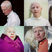 Paola de Grene's Albinos
