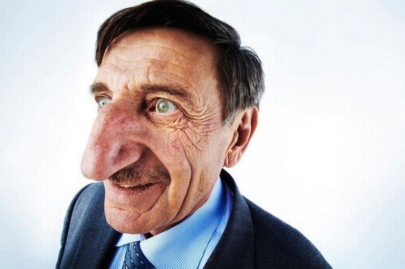 Pinocchio in real life: the man with the longest nose in the world