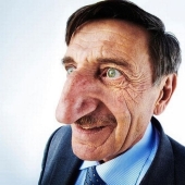 Pinocho en la vida real: el hombre con la nariz más larga del mundo