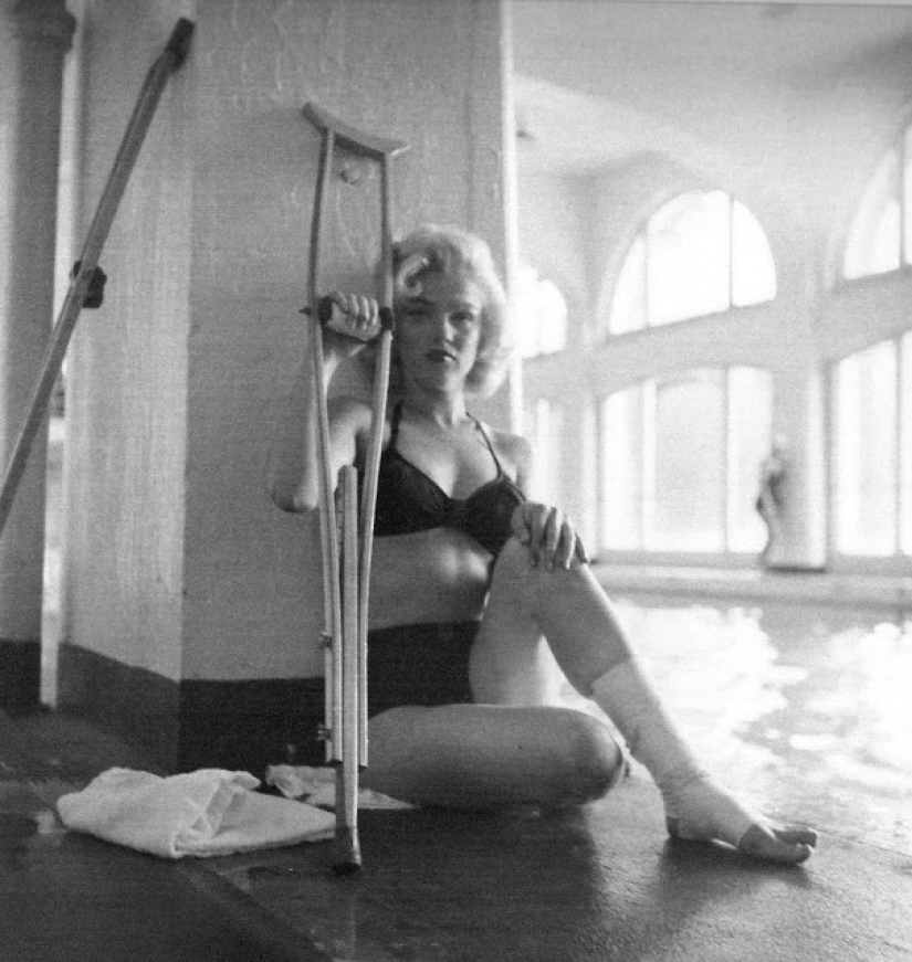 Plaster-beauty is not a hindrance: rare photos of Marilyn Monroe on crutches