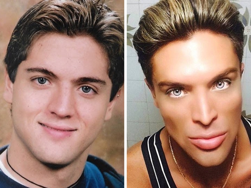 Plastic surgery victims - men