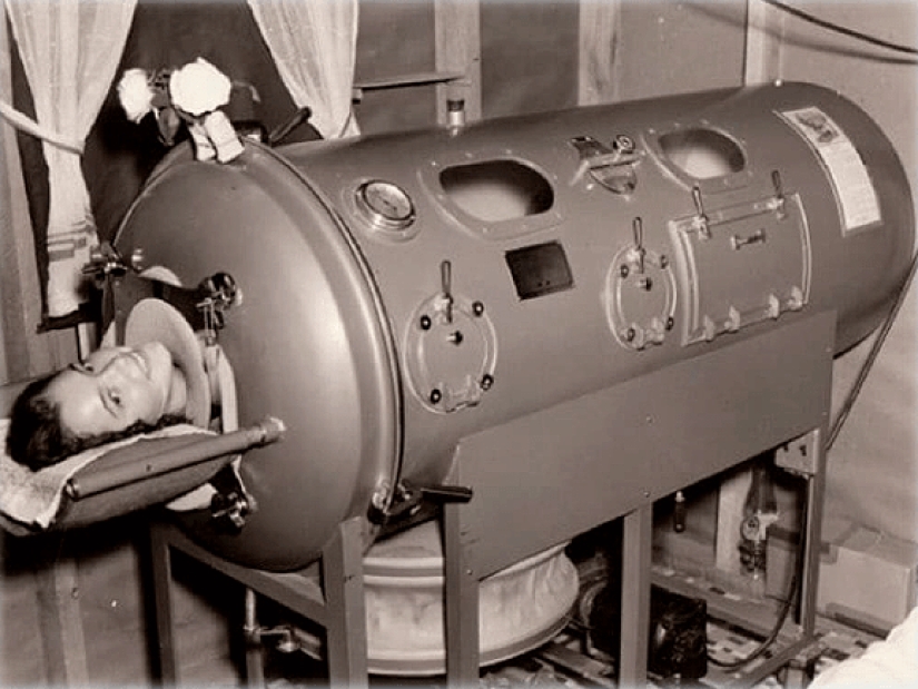 Prisoners of the "Iron lung": how to rescue victims of polio, have forgotten how to breathe