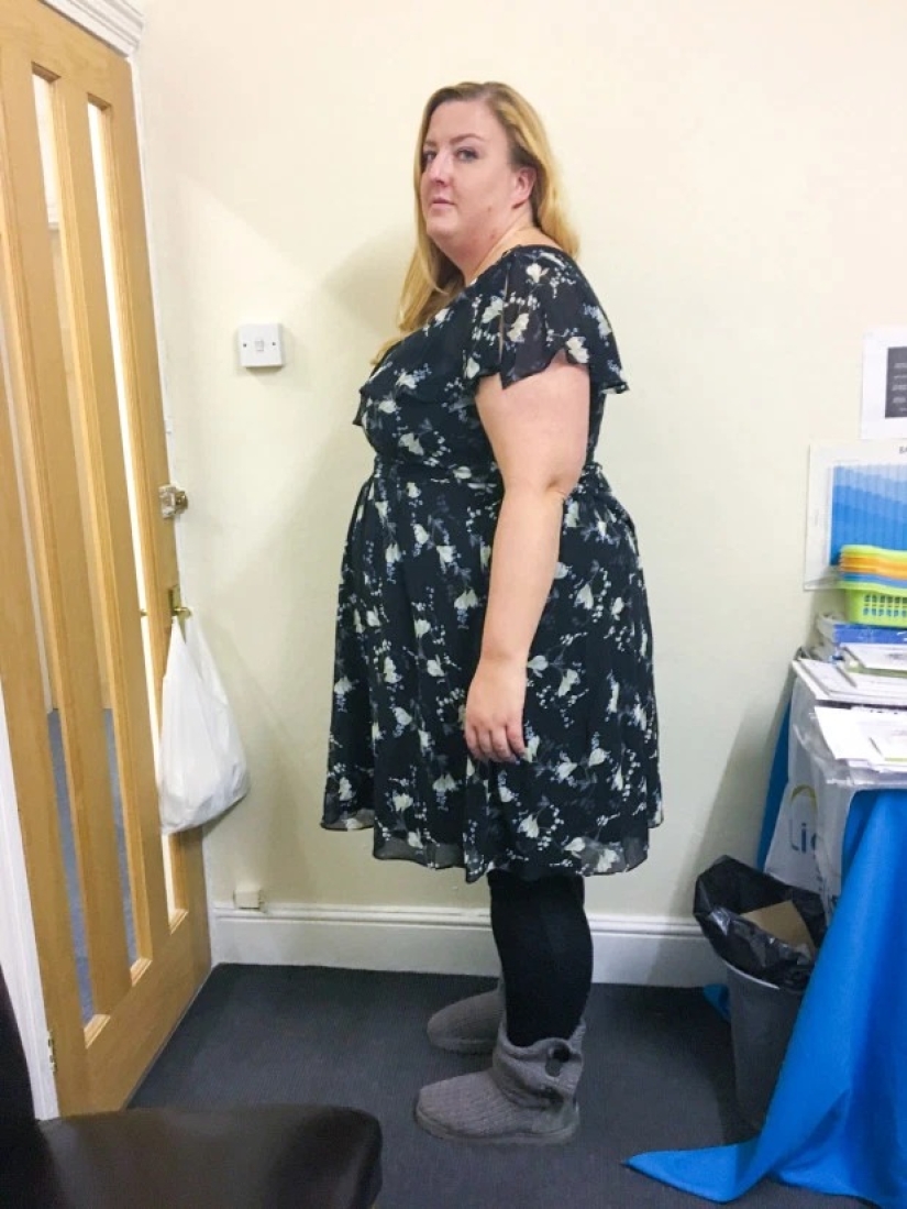 Pulled herself together: the woman got rid of snoring and lost 89 kg, refusing gastric banding