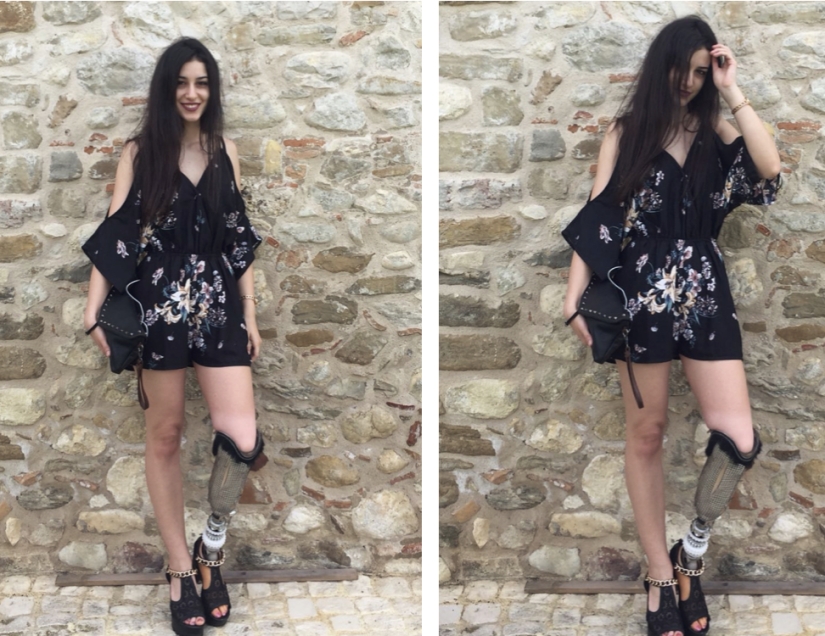 ¿Qué sabes de belleza? Una chica con una sola pierna llegó a la final de "Miss Italia"