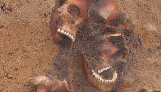 Restos de una mujer de la Edad Media con sífilis tropical encontrados en Lituania