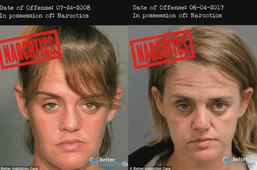 Rostros de drogadictos antes y después: cómo afectan las sustancias prohibidas a la apariencia