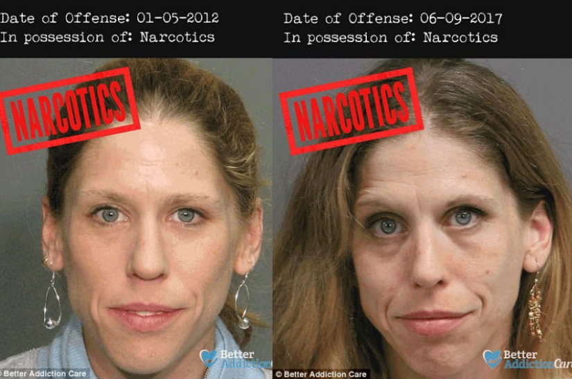 Rostros de drogadictos antes y después: cómo afectan las sustancias prohibidas a la apariencia