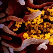 Scientists have shown what the Covid-19 coronavirus looks like under a microscope
