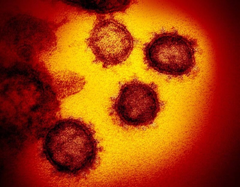 Scientists have shown what the Covid-19 coronavirus looks like under a microscope