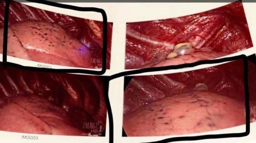 Shocking X-rays of light vapers