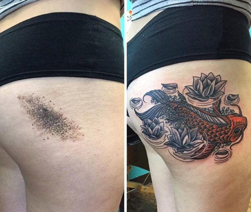 Tattoos that hide birthmarks