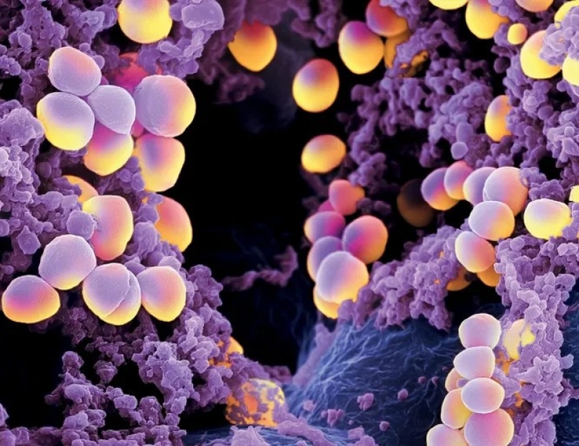 The 10 most dangerous bacteria