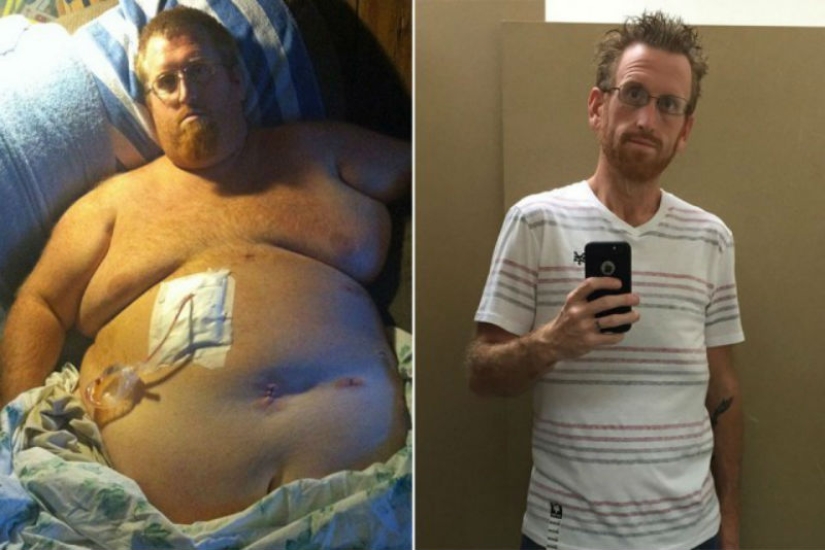 The American thought that being overweight would kill him, recorded a suicide video, and then took and lost 160 kg